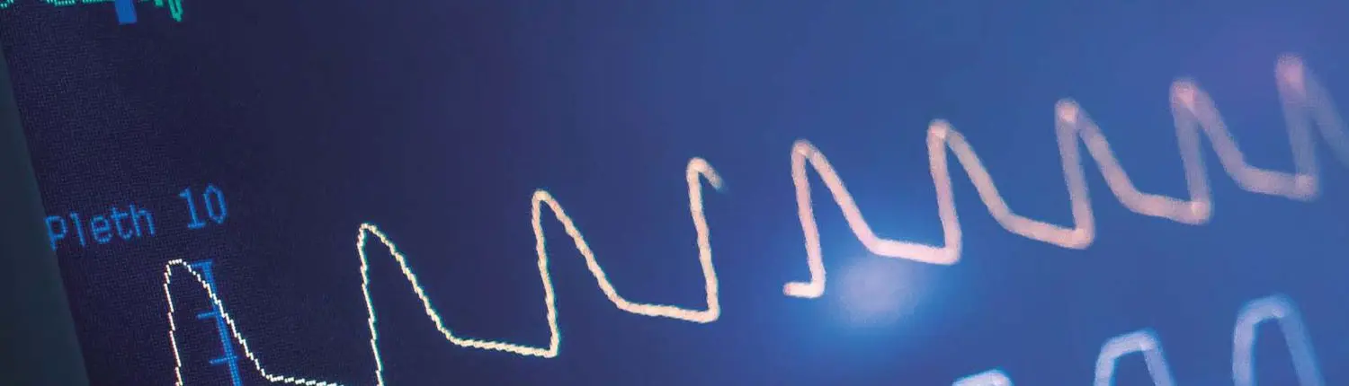 ECG Simulator Calibration