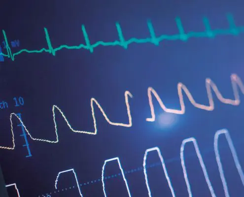 ECG Simulator Calibration