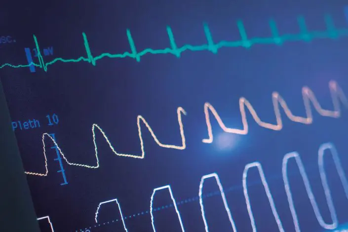ECG Simulator Calibration