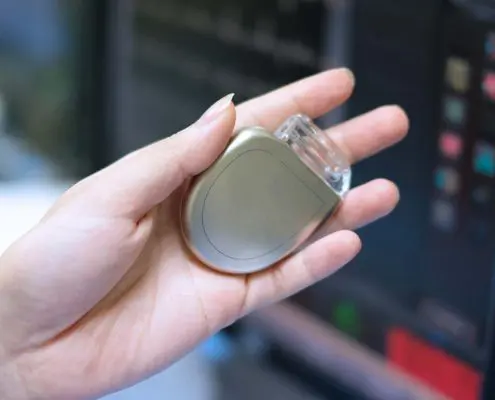 Pacemaker Analyzer Calibration