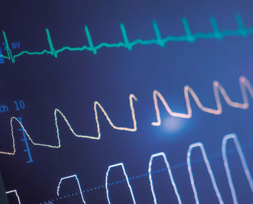 ECG Simulator Calibration