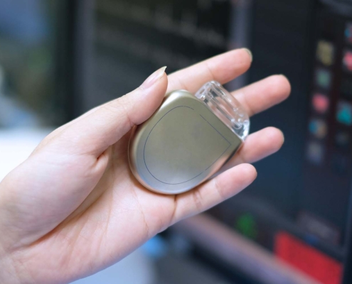 Pacemaker Analyzer Calibration